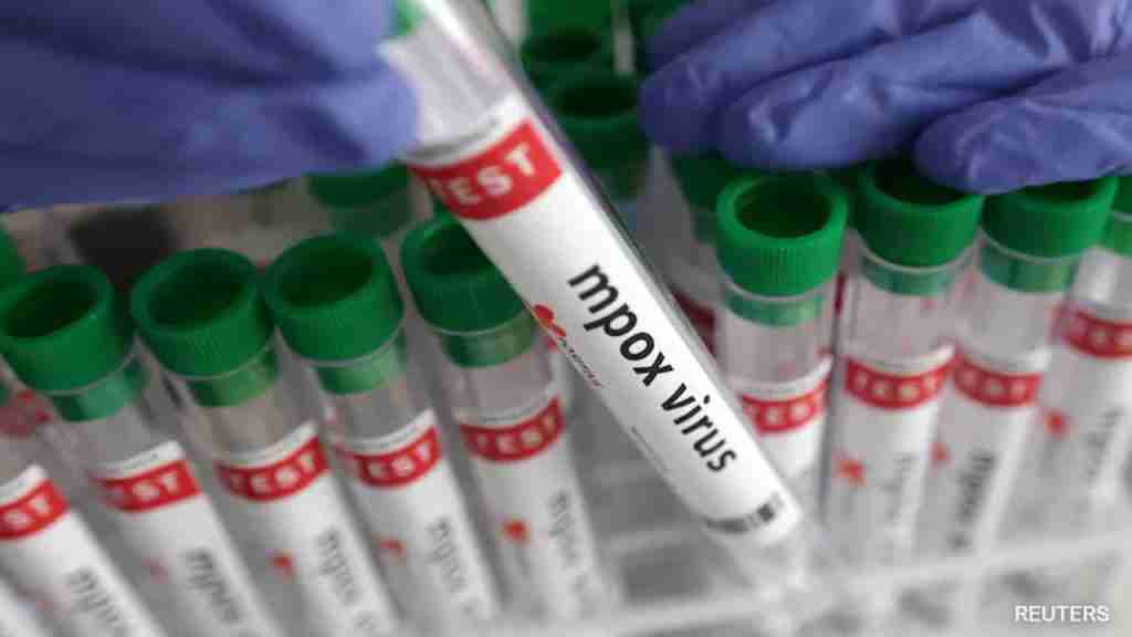 Mpox Is No Longer a Global Health Emergency: WHO 1 Mpox Is No Longer a Global Health Emergency: WHO